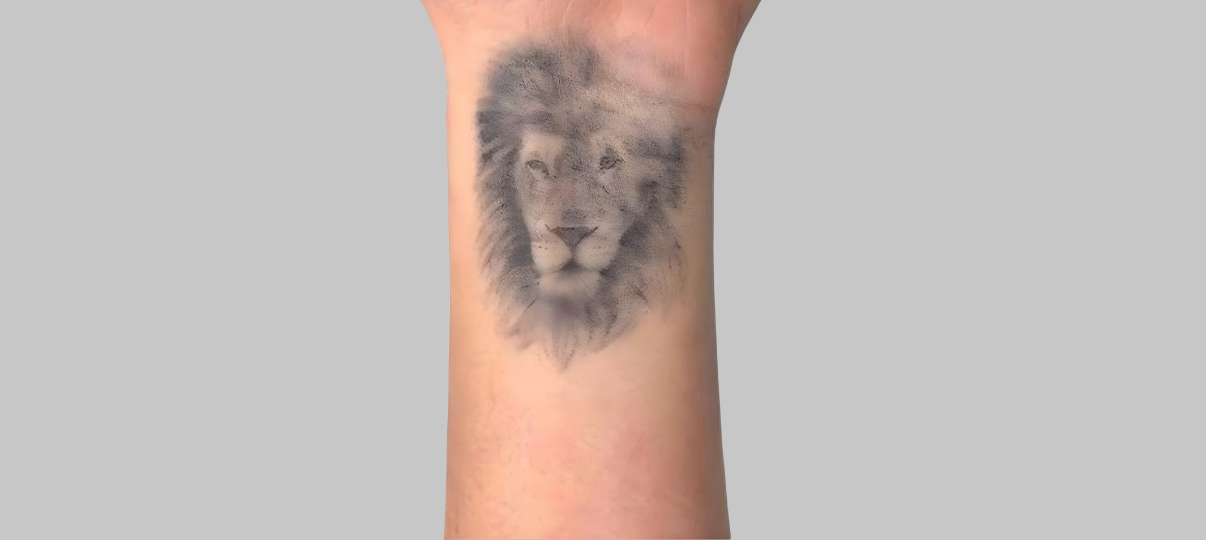 Before Treatment